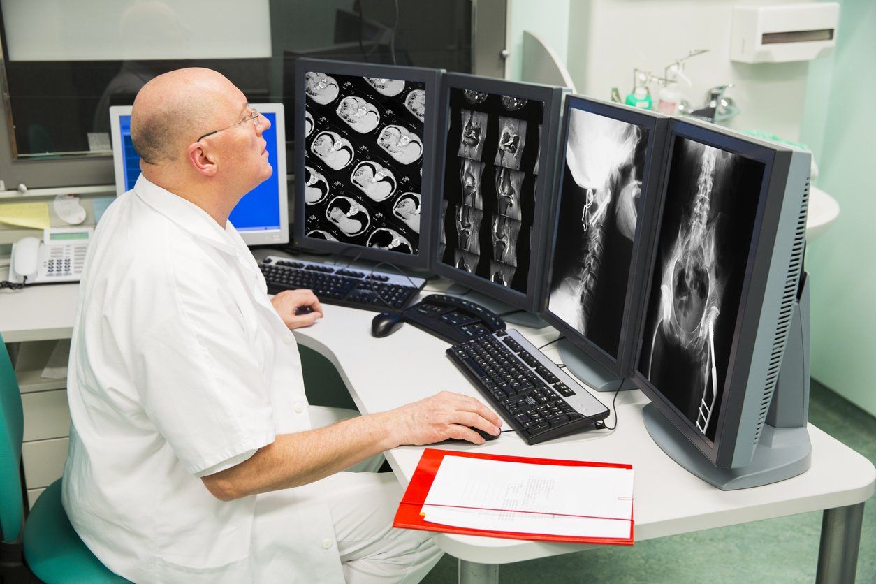 Senior radiologist of Oncology institute is examing X-Ray images stock photo